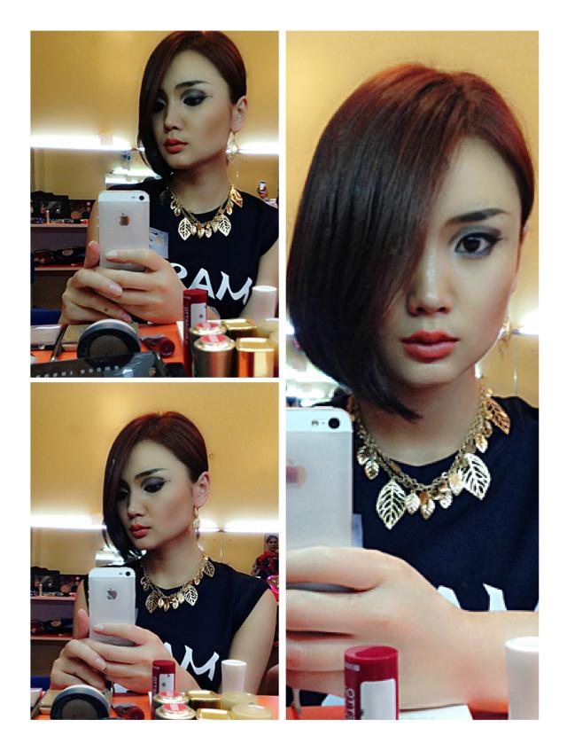 Г.Золзаяа: Одоо шууд хөх томруулах мэс засалд орохгүй